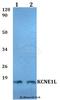 Potassium Voltage-Gated Channel Subfamily E Regulatory Subunit 5 antibody, A08848, Boster Biological Technology, Western Blot image 