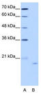 Nucleolar Protein 6 antibody, TA343921, Origene, Western Blot image 