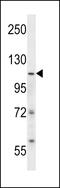 SWI/SNF Related, Matrix Associated, Actin Dependent Regulator Of Chromatin, Subfamily A, Member 5 antibody, 57-878, ProSci, Western Blot image 