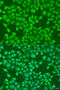 Acyl-CoA Oxidase 1 antibody, 23-395, ProSci, Immunofluorescence image 