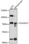 Collagen Beta(1-O)Galactosyltransferase 2 antibody, LS-C750378, Lifespan Biosciences, Western Blot image 