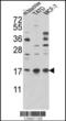 ARF6-Specific antibody, LS-B11684, Lifespan Biosciences, Western Blot image 