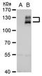 AXL Receptor Tyrosine Kinase antibody, PA5-28850, Invitrogen Antibodies, Western Blot image 