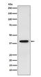 SET Nuclear Proto-Oncogene antibody, M02211, Boster Biological Technology, Western Blot image 