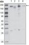 Macrophage Stimulating 1 Receptor antibody, GTX83174, GeneTex, Western Blot image 