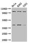 Proteasome 26S Subunit, Non-ATPase 2 antibody, CSB-PA619755LA01HU, Cusabio, Western Blot image 