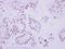 DNA Topoisomerase II Beta antibody, NBP2-20684, Novus Biologicals, Immunohistochemistry paraffin image 