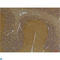Solute Carrier Family 12 Member 4 antibody, LS-C813644, Lifespan Biosciences, Immunohistochemistry paraffin image 