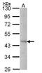 Dynein Axonemal Assembly Factor 4 antibody, GTX106296, GeneTex, Western Blot image 