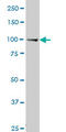 Muscle Associated Receptor Tyrosine Kinase antibody, LS-C133332, Lifespan Biosciences, Western Blot image 