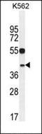 ABI Family Member 3 antibody, orb221333, Biorbyt, Western Blot image 