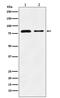 Scavenger Receptor Class B Member 2 antibody, M05090, Boster Biological Technology, Western Blot image 