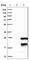 Titin-Cap antibody, HPA026477, Atlas Antibodies, Western Blot image 