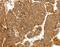 Collagen Type IV Alpha 1 Chain antibody, MBS2521740, MyBioSource, Immunohistochemistry paraffin image 