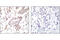 Histone Cluster 1 H2B Family Member B antibody, 2571S, Cell Signaling Technology, Immunohistochemistry paraffin image 