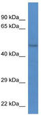 Serine/Threonine Kinase 32B antibody, TA340379, Origene, Western Blot image 