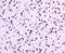 DNA Topoisomerase I antibody, NBP2-67606, Novus Biologicals, Immunohistochemistry paraffin image 