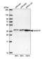 Nucleolar Protein Interacting With The FHA Domain Of MKI67 antibody, NBP2-48642, Novus Biologicals, Western Blot image 
