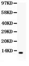 Defensin Beta 1 antibody, LS-C312609, Lifespan Biosciences, Western Blot image 