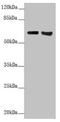 Keratin 6A antibody, LS-C675971, Lifespan Biosciences, Western Blot image 