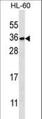 Phosphatidylinositol Transfer Protein Beta antibody, LS-C163739, Lifespan Biosciences, Western Blot image 