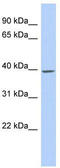 Transmembrane And Coiled-Coil Domain Family 1 antibody, TA335603, Origene, Western Blot image 