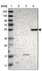 Leukocyte Immunoglobulin Like Receptor B5 antibody, NBP1-84575, Novus Biologicals, Western Blot image 