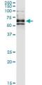 Dihydropyrimidinase Like 4 antibody, H00010570-M01, Novus Biologicals, Immunoprecipitation image 