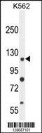 Ankyrin Repeat Domain 52 antibody, 55-436, ProSci, Western Blot image 