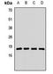 Ribosomal Protein L23a antibody, orb412241, Biorbyt, Western Blot image 