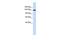 Dishevelled Associated Activator Of Morphogenesis 1 antibody, GTX45331, GeneTex, Western Blot image 