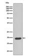 Caveolin 3 antibody, M00990-1, Boster Biological Technology, Western Blot image 