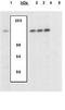 Nuclear Factor Of Activated T Cells 2 antibody, GTX25246, GeneTex, Western Blot image 