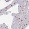 Zinc Finger And BTB Domain Containing 1 antibody, NBP2-31022, Novus Biologicals, Immunohistochemistry paraffin image 