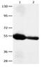 Carcinoembryonic Antigen Related Cell Adhesion Molecule 1 antibody, orb107370, Biorbyt, Western Blot image 