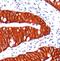Melanoma Associated Antigen KBA.62 antibody, 34062, QED Bioscience, Immunohistochemistry frozen image 