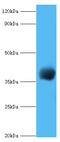 Pseudomonas sp.Carboxypeptidase G2 antibody, A54644-100, Epigentek, Western Blot image 