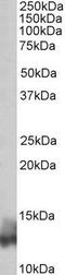 Phospholamban antibody, GTX88052, GeneTex, Western Blot image 