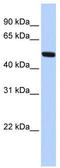 Meis Homeobox 2 antibody, TA341510, Origene, Western Blot image 