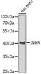 Inhibin Subunit Alpha antibody, GTX55680, GeneTex, Western Blot image 