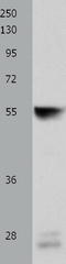 Cytochrome P450 Family 3 Subfamily A Member 4 antibody, TA324142, Origene, Western Blot image 