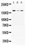 ADAMTS13 antibody, PA5-78727, Invitrogen Antibodies, Western Blot image 