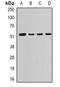 Calcium/Calmodulin Dependent Protein Kinase IG antibody, orb341289, Biorbyt, Western Blot image 