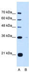 Torsin Family 1 Member B antibody, TA341941, Origene, Western Blot image 