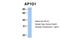 Adaptor Related Protein Complex 1 Subunit Gamma 1 antibody, NBP1-57633, Novus Biologicals, Western Blot image 