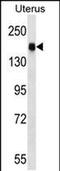 Cingulin Like 1 antibody, PA5-48808, Invitrogen Antibodies, Western Blot image 