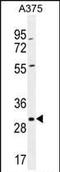 Coatomer Protein Complex Subunit Epsilon antibody, PA5-35043, Invitrogen Antibodies, Western Blot image 