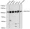 Cell Proliferation Regulating Inhibitor Of Protein Phosphatase 2A antibody, A32369, Boster Biological Technology, Western Blot image 