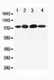 Nuclear Receptor Subfamily 3 Group C Member 2 antibody, PA1594, Boster Biological Technology, Western Blot image 