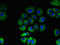 Taste 1 Receptor Member 2 antibody, orb53671, Biorbyt, Immunofluorescence image 